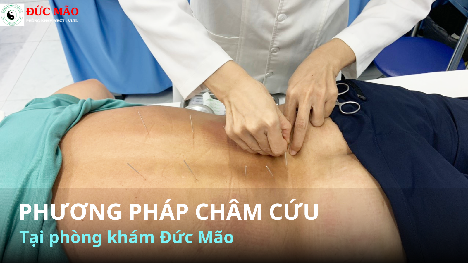 Phương pháp châm cứu tại Phòng khám vật lý trị y học cổ truyền quận 12 Đức Mão