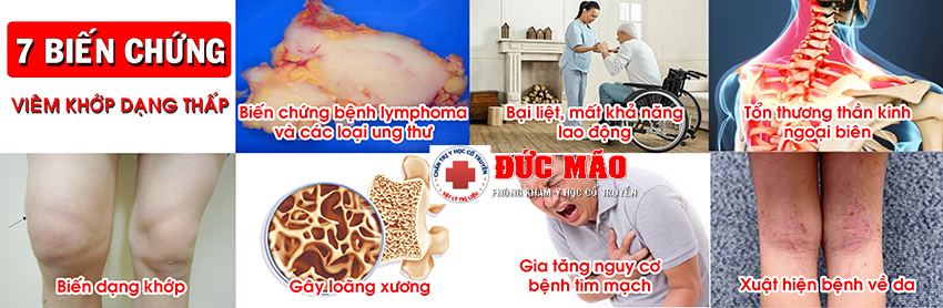 Phòng khám xương khớp TPHCM Tốt nhất Quận 12, Gò Vấp 