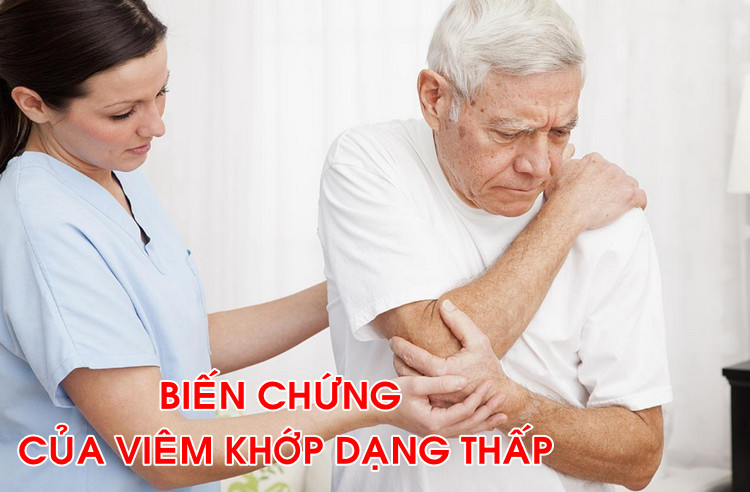 Viêm khớp dạng thấp là gì? Nguyên nhân và điều trị Viêm khớp dạng thấp